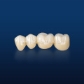 High Quality Multilayered Zirconia for Dental Restorations